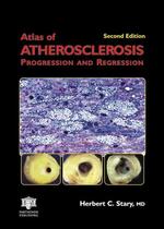 Atlas of Atherosclerosis : Progression and Regression (Encyclopedia of Visual Medicine Series) （2ND）