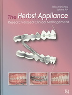 The Herbst Appliance : Research Based Clinical Management