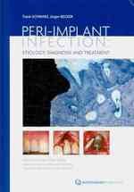 Peri-Implant Infection Etiology : Diagnosis and Treatment