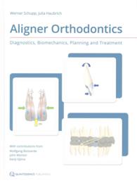 Aligner Orthodontics