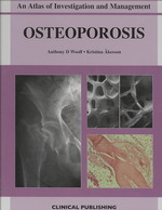 Osteoporosis : An Atlas of Investigation and Diagnosis （1ST）