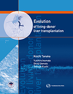 生体肝移植の進化<br>Evolution of Living-Donor Liver Tranplantation