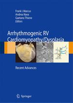 Arrhythmogenic Right Ventricular Cardiomyopathy/Dysplasia : Recent Advances