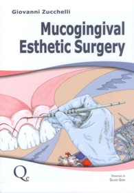 Mucogingival Esthetic Surgery