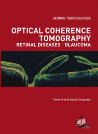 Optical Coherence Tomography Retinal Diseases-Glucoma （1ST）