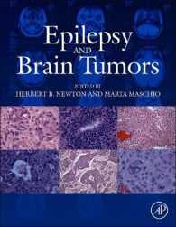てんかんと脳腫瘍<br>Epilepsy and Brain Tumors