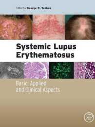 Systemic Lupus Erythematosus: Basic， Applied and Clinical Aspects