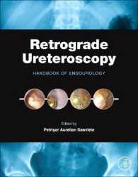 Retrograde Ureteroscopy : Handbook of Endourology
