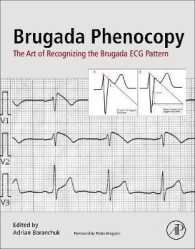 Brugada Phenocopy : The Art of Recognizing the Brugada ECG Pattern