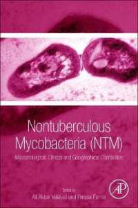 非結核抗酸菌<br>Nontuberculous Mycobacteria (NTM) : Microbiological, Clinical and Geographical Distribution