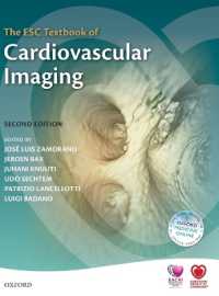 心血管画像診断：ESCテキスト（第２版）<br>The ESC Textbook of Cardiovascular Imaging (The European Society of Cardiology Series) （2ND）