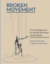 Broken Movement: The Neurobiology of Motor Recovery After Stroke