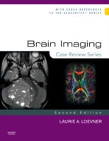 Brain Imaging: Case Review Series (Case Review) （2ND）