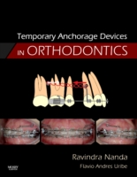Temporary Anchorage Devices in Orthodontics （1ST）