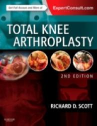 人工膝関節全置換術（第２版）<br>Total Knee Arthroplasty (Total Knee Arthroplasty) （2 HAR/PSC）