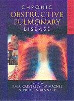 Chronic Obstructive Pulmonary Disease （2ND）