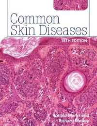 一般皮膚疾患（第１８版）<br>Common Skin Diseases 18th edition : ISE （18TH）