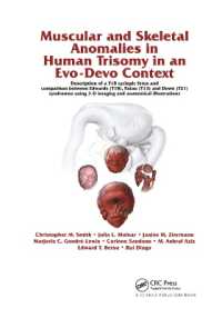 Muscular and Skeletal Anomalies in Human Trisomy in an Evo-Devo Context : Description of a T18 Cyclopic Fetus and Comparison between Edwards (T18), Patau (T13) and Down (T21) Syndromes Using 3-D Imaging and Anatomical Illustrations