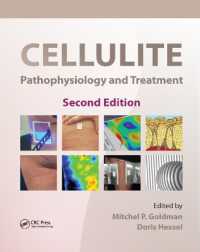Cellulite : Pathophysiology and Treatment （2ND）
