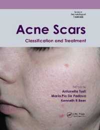 Acne Scars : Classification and Treatment (Series in Dermatological Treatment)