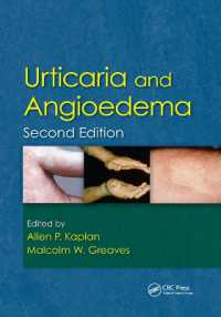 Urticaria and Angioedema （2ND）