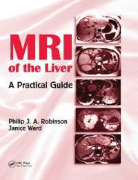 MRI of the Liver : A Practical Guide