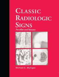 Classic Radiologic Signs : An Atlas and History