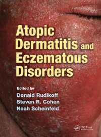 Atopic Dermatitis and Eczematous Disorders