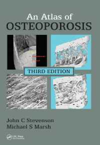 An Atlas of Osteoporosis （3RD）