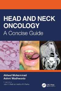 頭頸部の腫瘍学：コンサイス・ガイド<br>Head and Neck Oncology : A Concise Guide