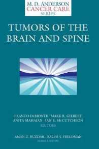 Tumors of the Brain and Spine (M. D. Anderson Cancer Care Series)