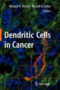 癌における樹状細胞<br>Dendritic Cells in Cancer