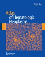 血液腫瘍アトラス<br>Atlas of Hematologic Neoplasms