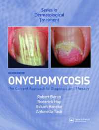 Onychomycosis : The Current Approach to Diagnosis and Therapy （2ND）