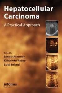 Hepatocellular Carcinoma : A Practical Approach