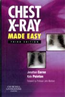 やさしい胸部X線の読み方（第３版）<br>Chest X-Ray Made Easy (Made Easy) （3TH）