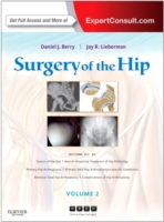 股関節の外科手術<br>Surgery of the Hip : Expert Consult - Online and Print （HAR/PSC）