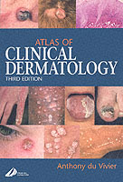 臨床皮膚病学アトラス（第３版）<br>Atlas of Clinical Dermatology