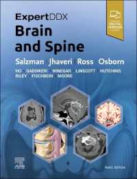 脳と脊椎：エキスパート鑑別診断シリーズ（第３版）<br>ExpertDDx: Brain and Spine (Expertddx) （3RD）
