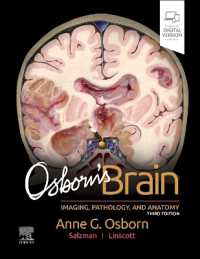 オズボーン脳画像診断（第３版）<br>Osborn's Brain （3RD）