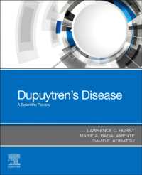 Dupuytren's Disease : A Scientific Review
