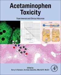 Acetaminophen Toxicity : Experimental and Clinical Advances