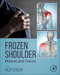 Frozen Shoulder : Present and Future