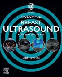 Breast Ultrasound : How, Why and When (How, Why and When) （2ND）