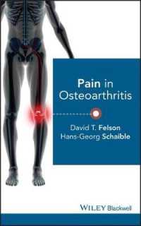 変形性関節症における疼痛<br>Pain in Osteoarthritis