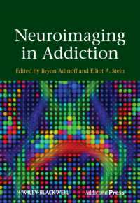 嗜癖における神経画像<br>Neuroimaging in Addiction