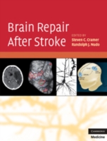 脳卒中後の脳修復<br>Brain Repair after Stroke