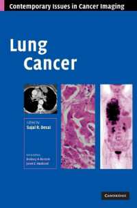 Lung Cancer (Contemporary Issues in Cancer Imaging)