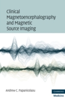 臨床脳磁図（MEG）とMSI<br>Clinical Magnetoencephalography and Magnetic Source Imaging