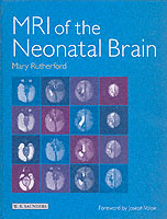 Mri of the Neonatal Brain